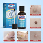 Rouclo Natural Removal Fluid, Suitable for Hands, Feet, Neck and Other Areas, Mild and Non-Irritating, Suitable for Adults and Children Aged 3 Years and Above 15ml