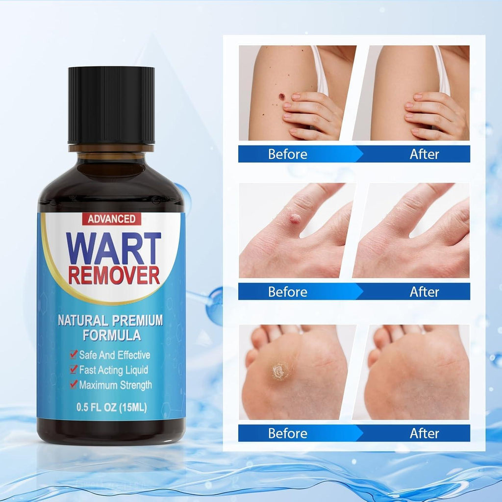 Rouclo Natural Removal Fluid, Suitable for Hands, Feet, Neck and Other Areas, Mild and Non-Irritating, Suitable for Adults and Children Aged 3 Years and Above 15ml