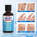 Rouclo Natural Removal Fluid, Suitable for Hands, Feet, Neck and Other Areas, Mild and Non-Irritating, Suitable for Adults and Children Aged 3 Years and Above 15ml
