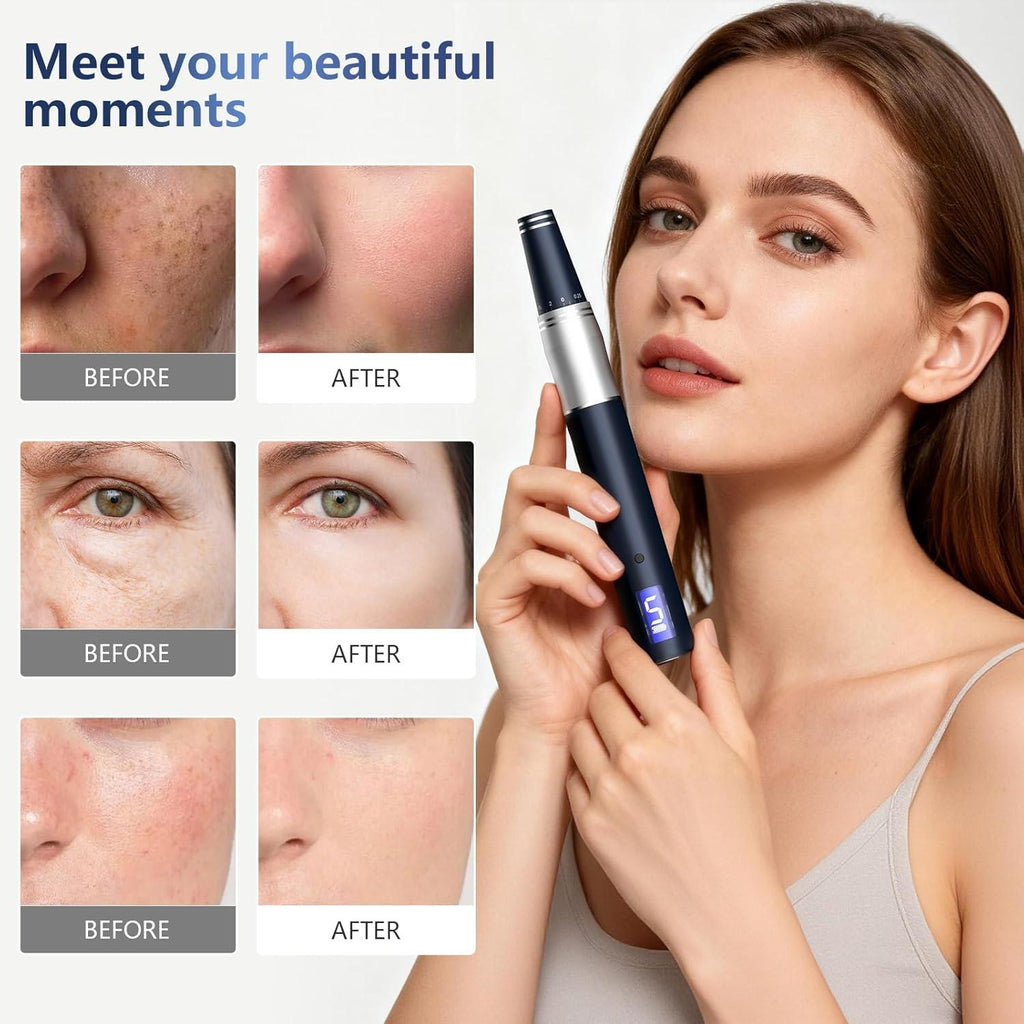 Rouclo Microneedling Pen with LCD Display, Dermapen, 5-Level Speed Control, Micro Needling Set, Includes 24 Needles, Derma Pen for Microneedling, Professional Electric Dermapen