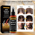 Rouclo Rosemary Oil Hair - Hair Growth Serum with Organic Castor Oil & Biotin for Women & Men, Supports Stronger Hair for Hair Loss, Rosemary Water for Hair & Beard Growth Agent Men, 60 ml